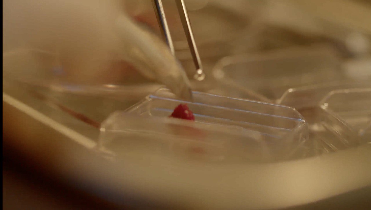 Банк людського тіла і нелюдська війна: Інститут клітинної біореабілітації №5