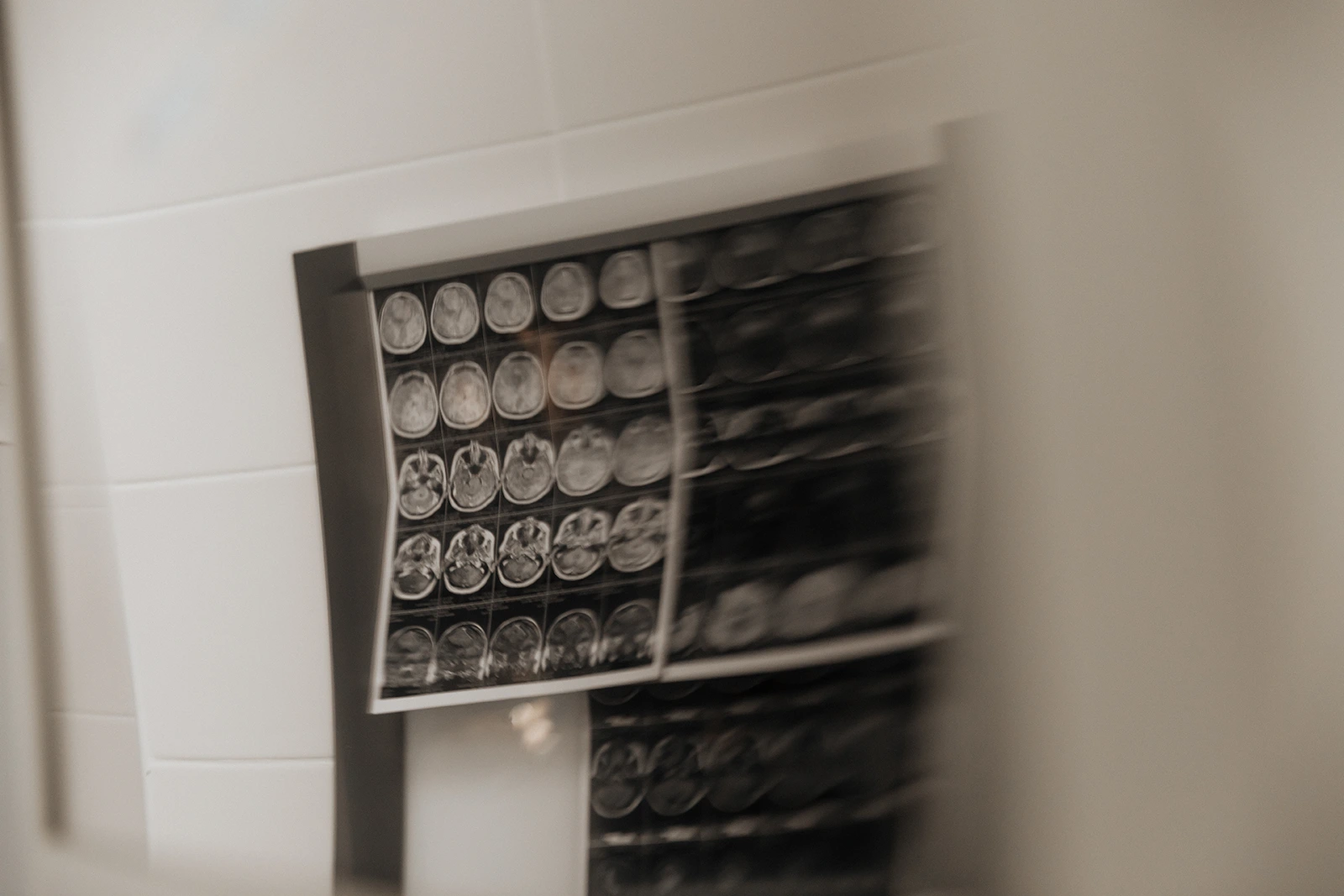 Як працює Інститут нейрохірургії під час великої війни №11